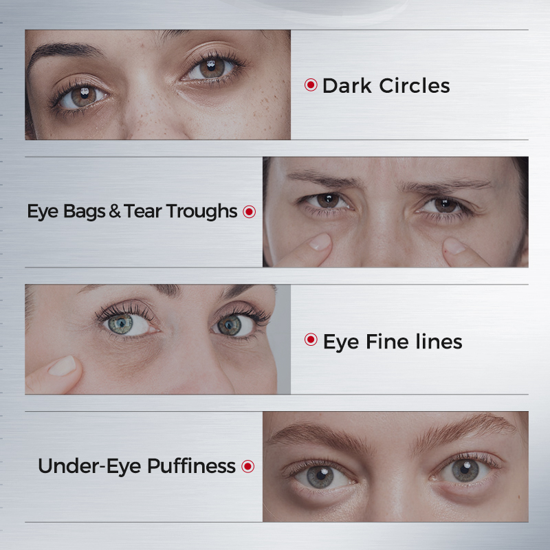 Koyu Halkalar için Göz Bantlar - Collagen Eye Patch incelemesi ve fiyatı